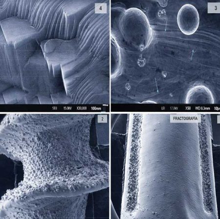 Fractografía Universum Dental